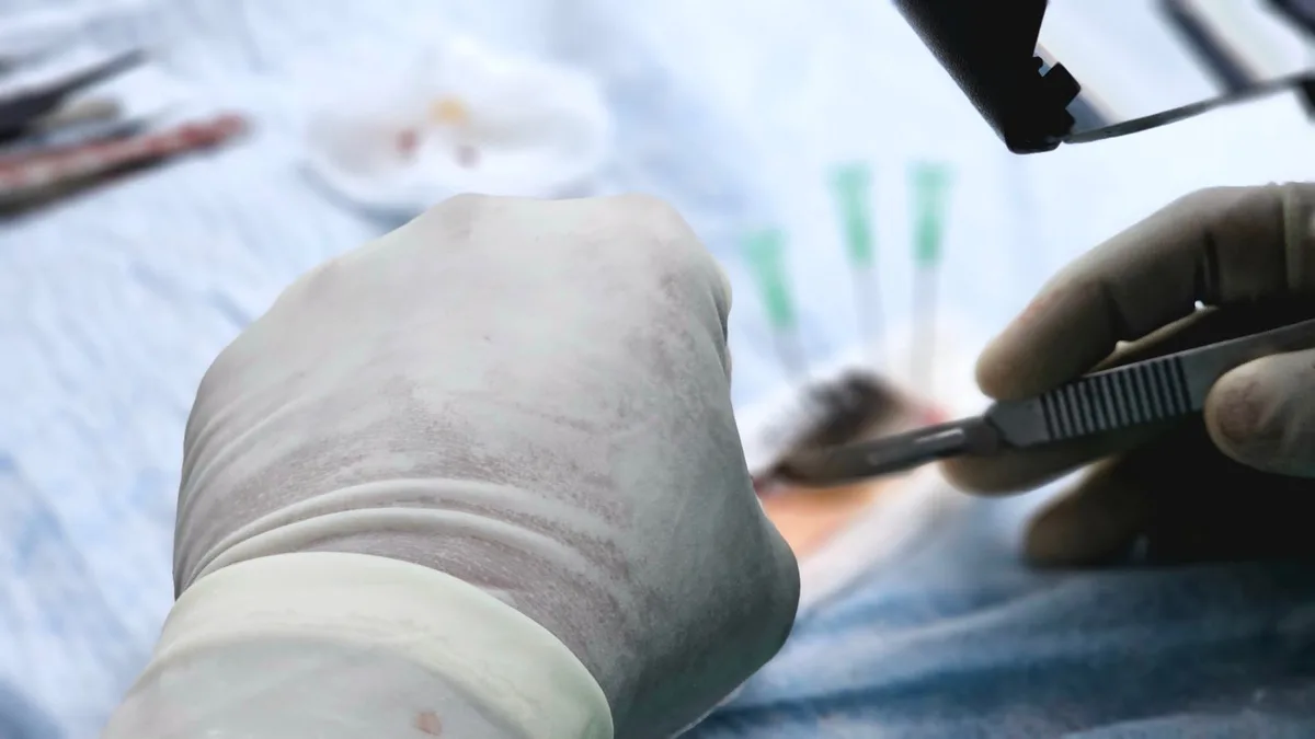 Dłoń w rękawiczce chirurgicznej trzymająca skalpel podczas zabiegu